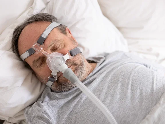 Obstructive sleep apnea in adults - sleeping patient (male) 4